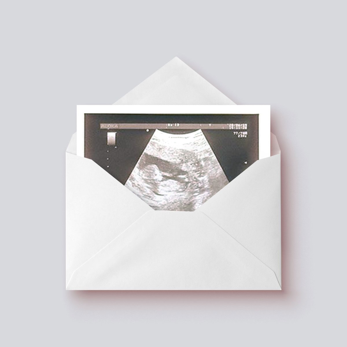 Ecografía Ilustrada - Imagen 4