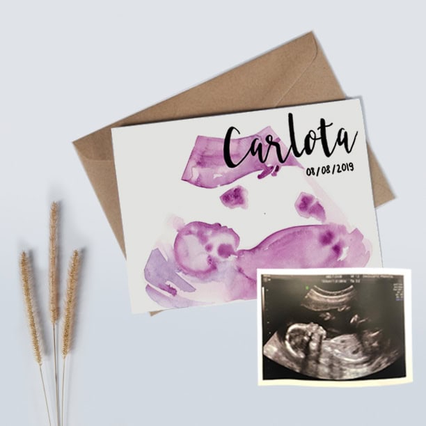 ecografia-ilustracion-barcelona