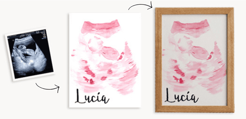 cuadro ecografia recien nancido